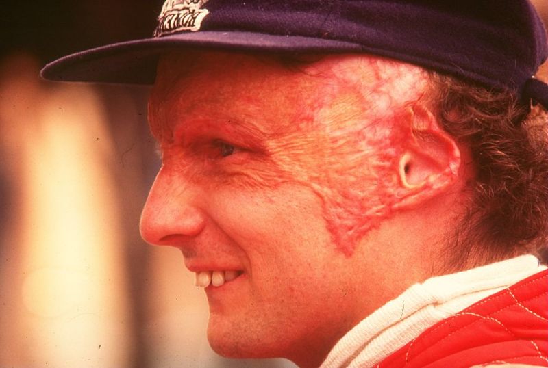 Niki Lauda (1)