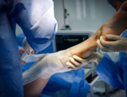 Why Experience Is the One Thing That Really Matters in a Personal Injury Attorney